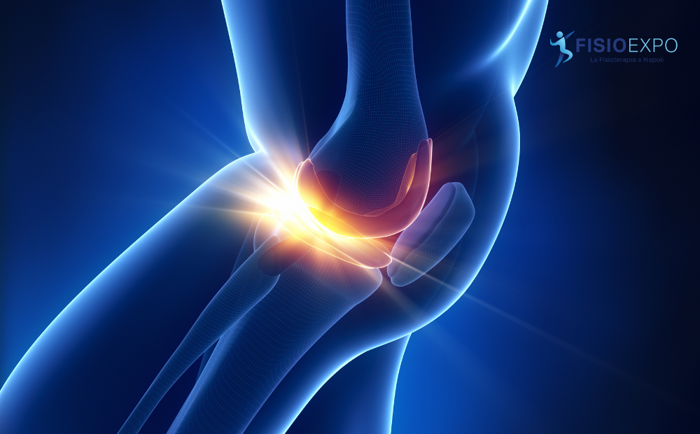 riabilitazione dopo meniscectomia tendine Achille trattamento